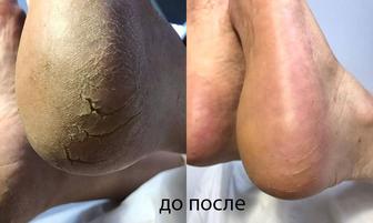 Смарт педикюр