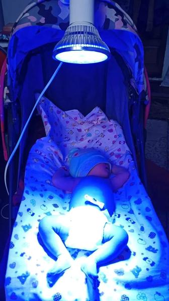 Фотолампа от желтухи