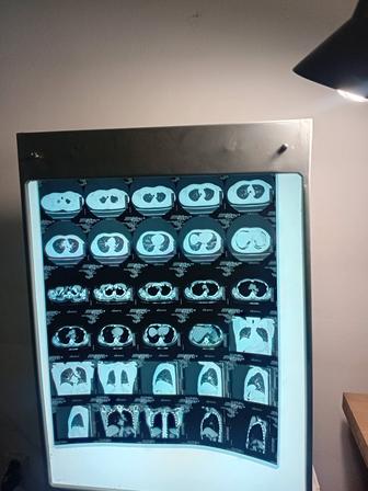 Продам негатоскоп