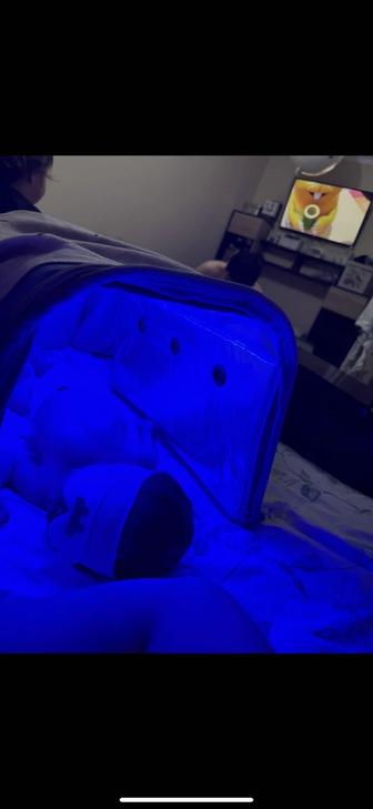 Лампа от желтушки