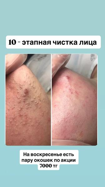 10 этапная чистка лица