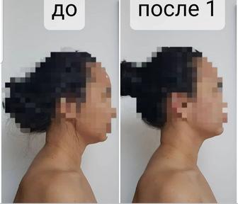 Массаж шейно-воротниковой зоны