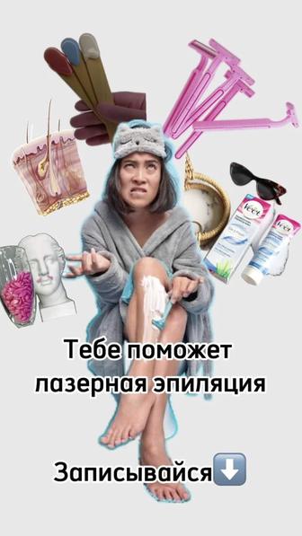 Лазерная эпиляция