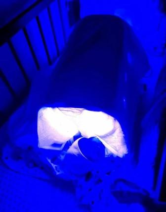 Новая Билирубиновая Фотолампа от желтушки для детей кювез фотосинтезз