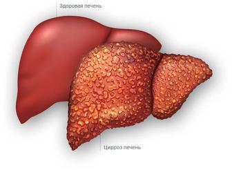 Очищение печени