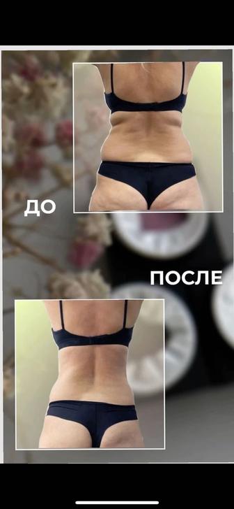 Нужны модели на аппаратную коррекцию фигуры