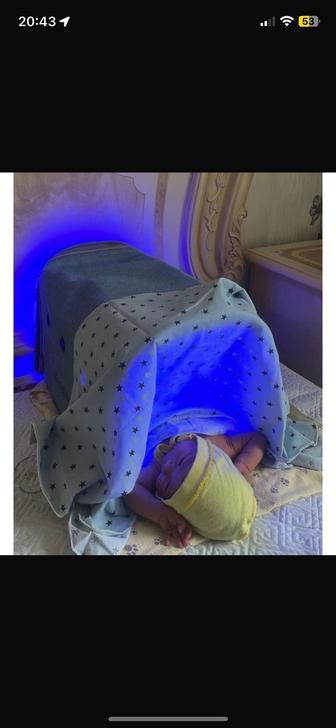 Лампа Кювез от желтушки 1 день