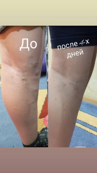 Лечебный пластырь