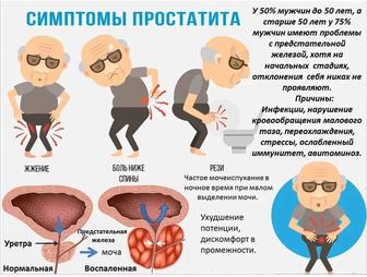 Лечение неинфекционного простатита