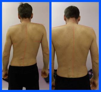 Мануальная терапия, остеопатия, кинезиология