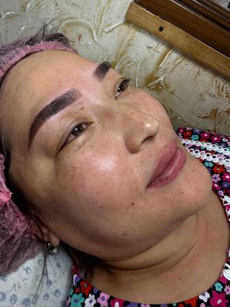 Лазерное удаление без боли без крови