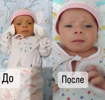 Аренда фотолампа от желтушки
