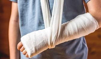 Гипсовая лангета уход, замена.