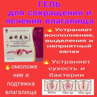 Женский бонус гель для сокращения и лечение киста вагинит
