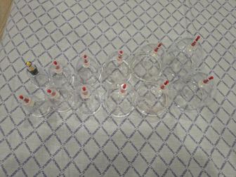 Банки для хиджамы