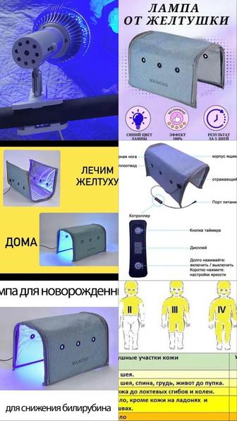 Аренда фотолампы от желтушки