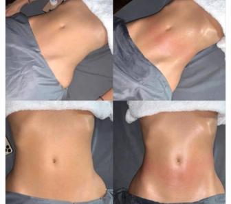 Антицеллюлитный программа для похудения.