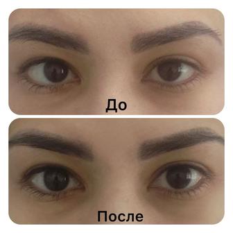 Реабилитация Мед. Массаж и ЛФК после Инсульта, Инфаркта, ДЦП,после операции