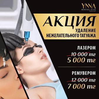 Удаление татуажа лазером и ремувером