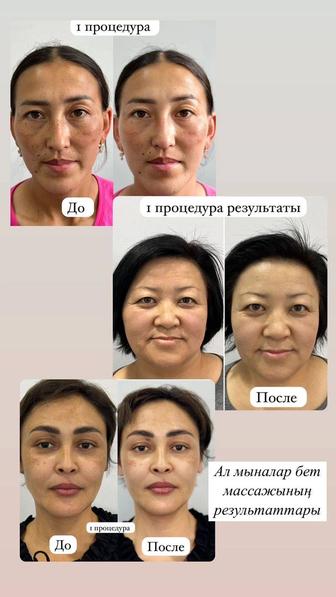 Массаж скульптурная для лица,Аппаратная чистка лица,увлажнение питание