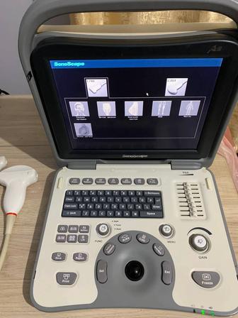 Продам портативный узи аппарат