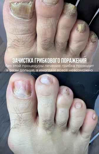 Подолог с 10 летним стажем. Медицинский педикюр.