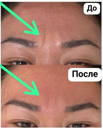 Скульптурный массаж лица.