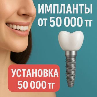 Имплантация в Астане. Импланты Астана