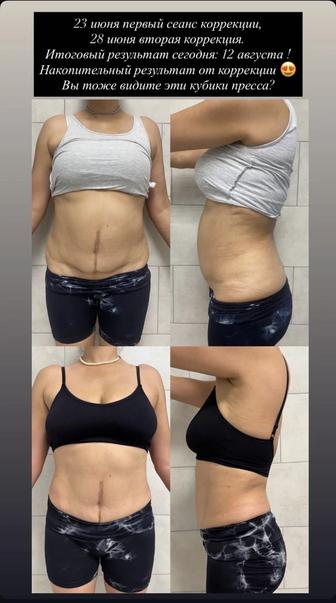 Послеродовое восстановление