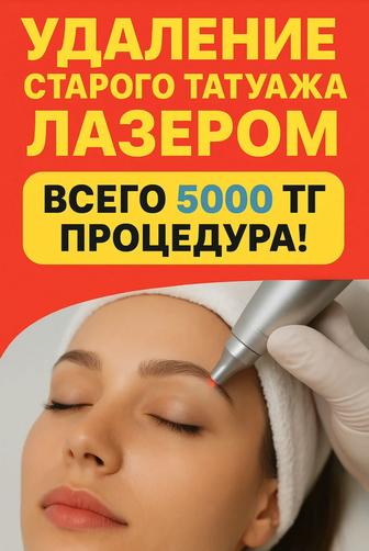 Лазерное удаление татуажа