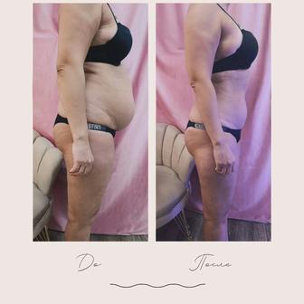 Курс мастер аппаратной косметологи. Косметолог эстет .