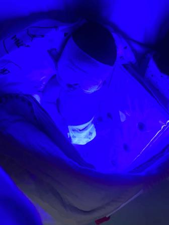 Сдается в аренду лампа от желтухи для новорожденных.