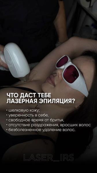 Лазерная эпиляция