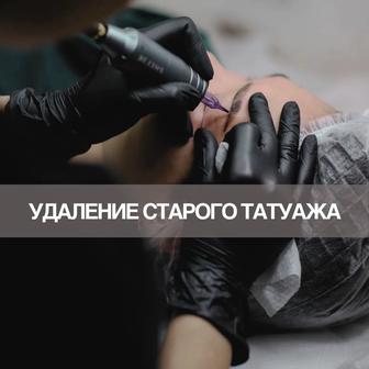 Удаление татуажа