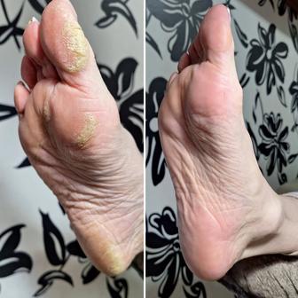 Маникюр ,Педикюр Емшан