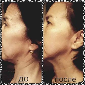 Услуги косметолога эстетиста