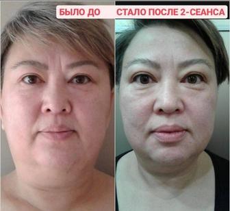 Ручная лепка лица. Безинъекционное омоложение
