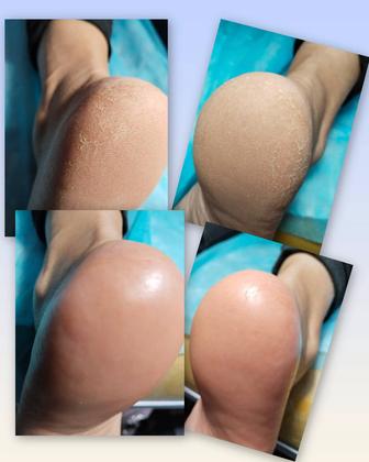 Маникюр, педикюр