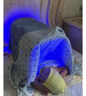 Фотолампа от желтушки