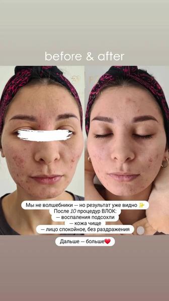 Кабинет физиотерапии и биоэнергомассажа PRO ZDOROVIE здоровье и энергия