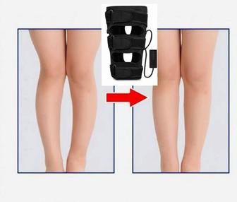 Аппаратная коррекция О образных и Х образных ног.