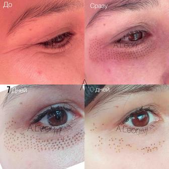 Горячая плазма (оригинальный аппарат)