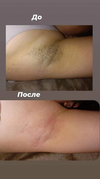 Делаю шугаринг на выезд