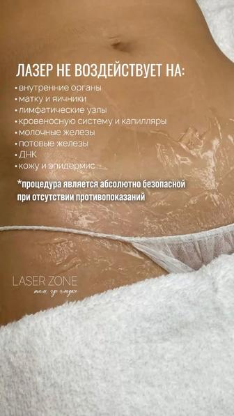 Лазерная эпиляция, акция