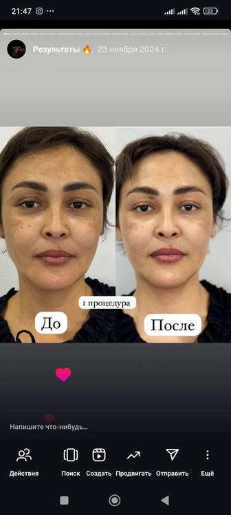 Косметологические процедуры(на лицо ,тело.Массаж ультразвуковым фонофорезом
