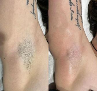 Женский мастер по депиляции