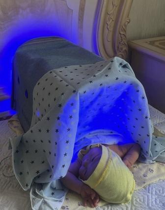 Фотолампа от желтушки