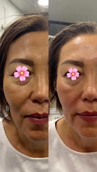 Массаж лица