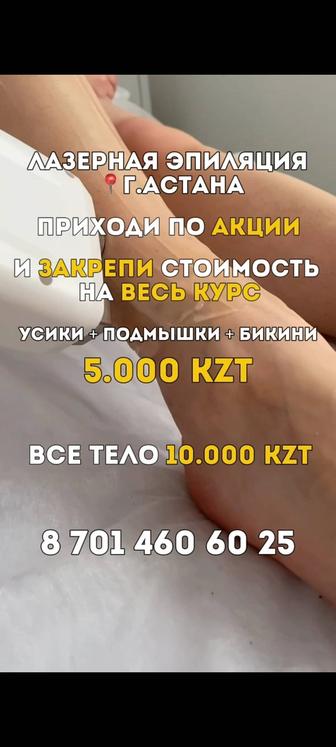 Лазерная эпиляция