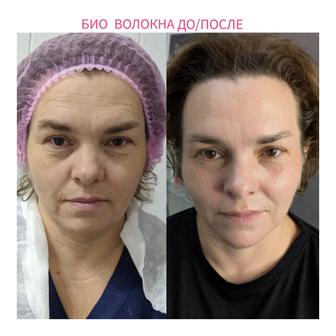 Косметолог Био Волокна